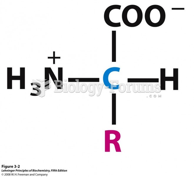 General structure of an amino acid