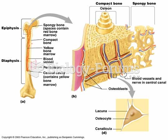 bone structure