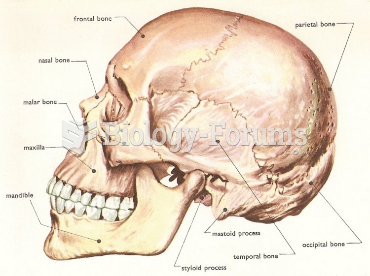 skull side 2