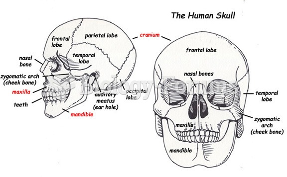 skull labeled