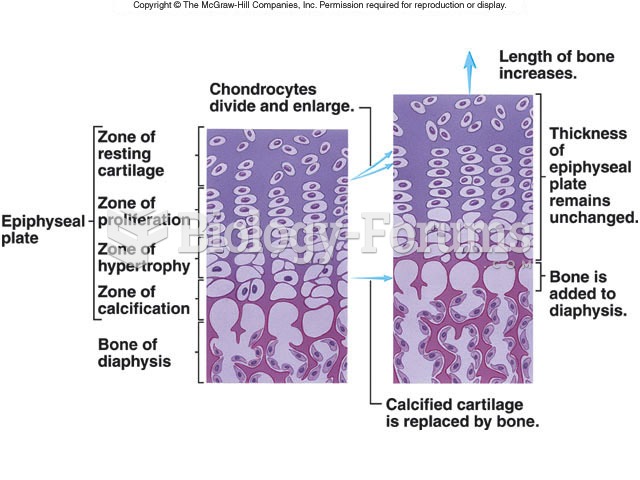 ossification of bone