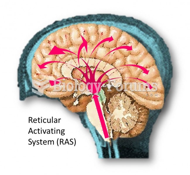 brain connections