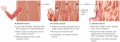 Three types of muscle tissue