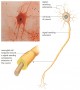 Micrograph and graphic of a motor neuron