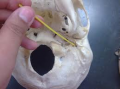Stylomastoid foramen