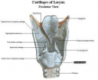 Arytenoid Cartilage