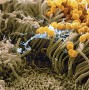 Staphylococcus aureus cells (yellow) stuck in mucus secreted by human nasal epithelial cells.