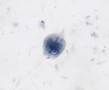 Giardia lamblia