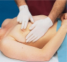 Palpation of the Breasts while Patient is Supine, Palpation of the Areola