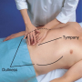 Percussion for Ascites: Shifting Dullness, Patient Supine