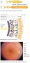 Structure of the retina