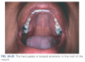 The hard palate is located anteriorly in the roof of the mouth