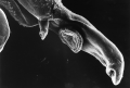 schistosome parasite