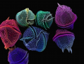 Electron microscopic image of dinoflagellates