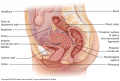 Common sites of endometriosis formation.