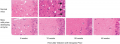 Experimental Treatment of a Prion Protein Infection 