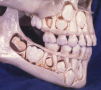 Skull tooth growth