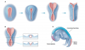 Formation of the Neural Tube  and Neural Tube Defects