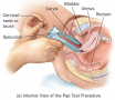 The Pap Test