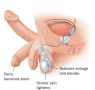 Physical Changes in the Male During the Excitement Phase