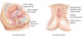 Physical Changes in the Female During the Plateau Phase