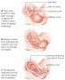 Expulsion of fetus and afterbirth during normal delivery. The afterbirth consists of the placenta, t