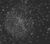 Human embryonic stem cells forming rosettes, a sign of neural differentiation