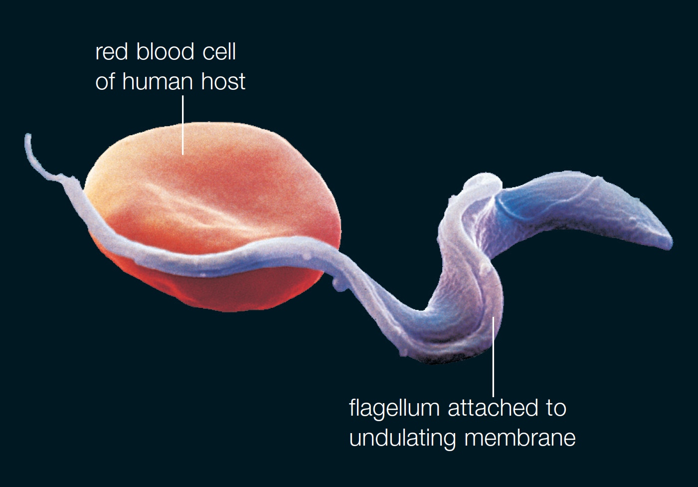 Trypanosoma brucei