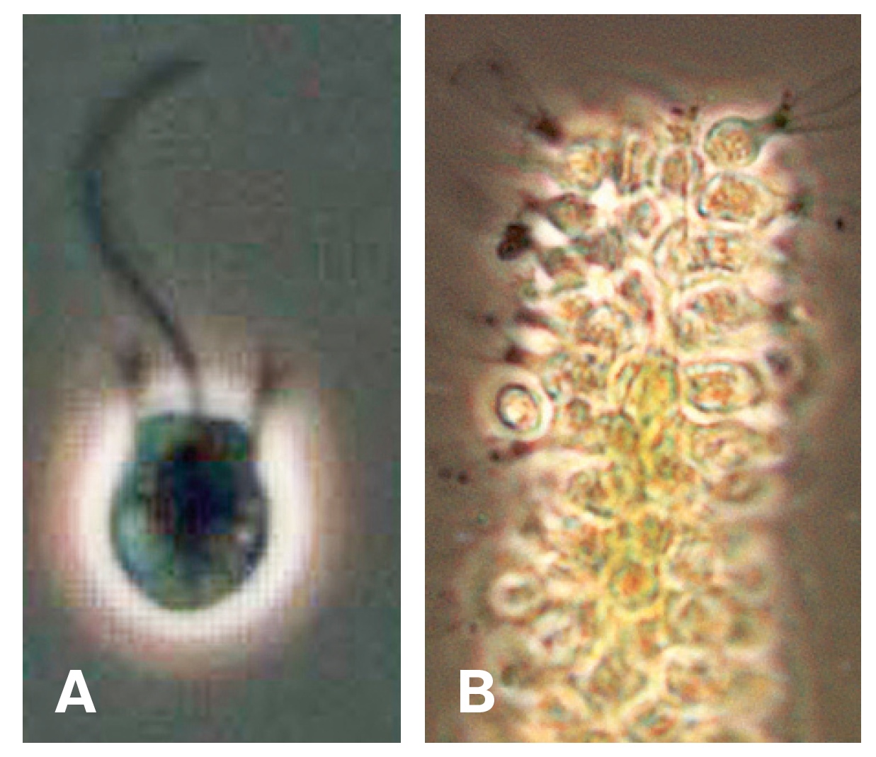 Choanoflagellates