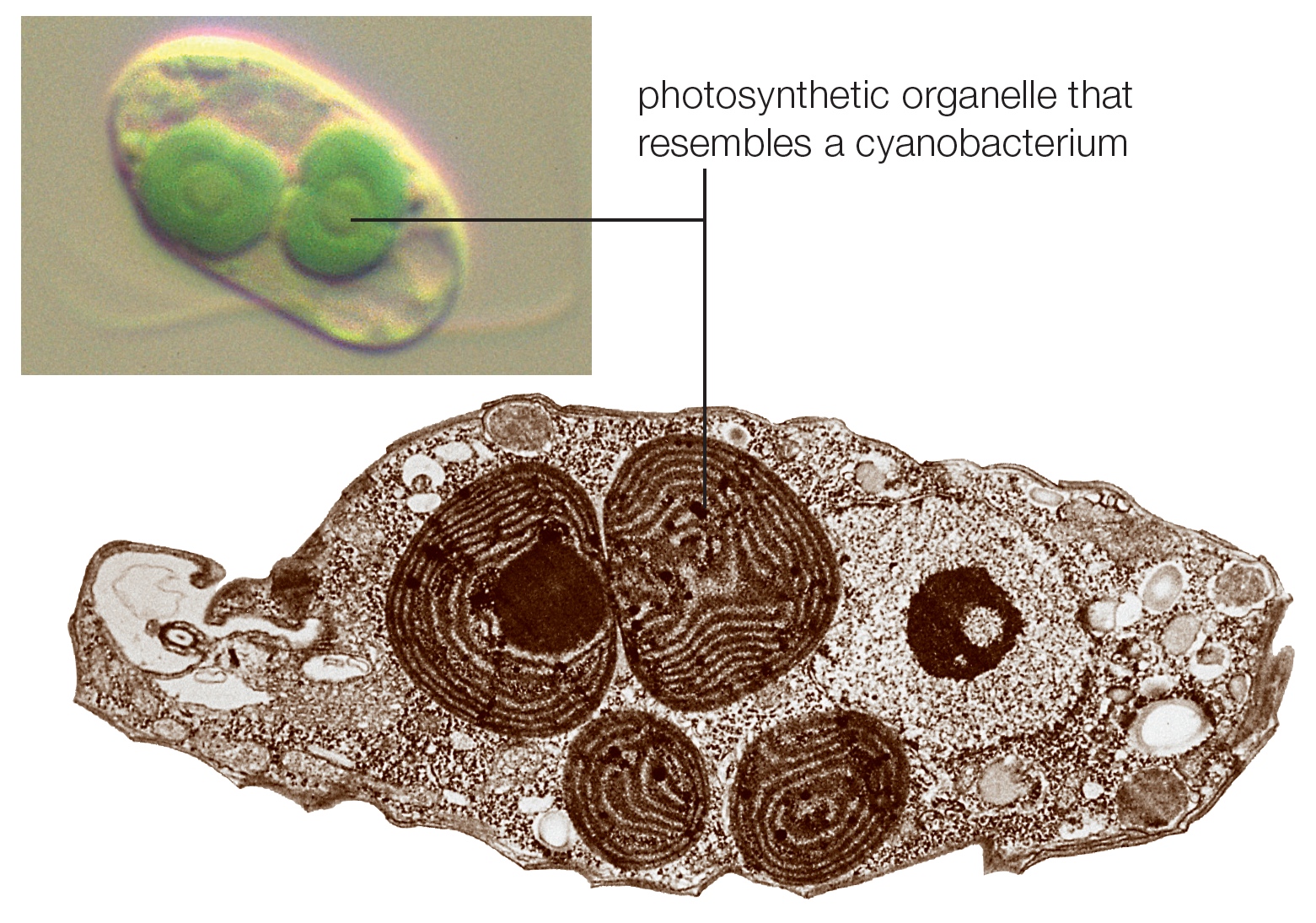 Cyanophora paradoxa