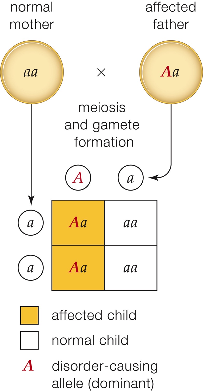 Autosomal dominant inheritance