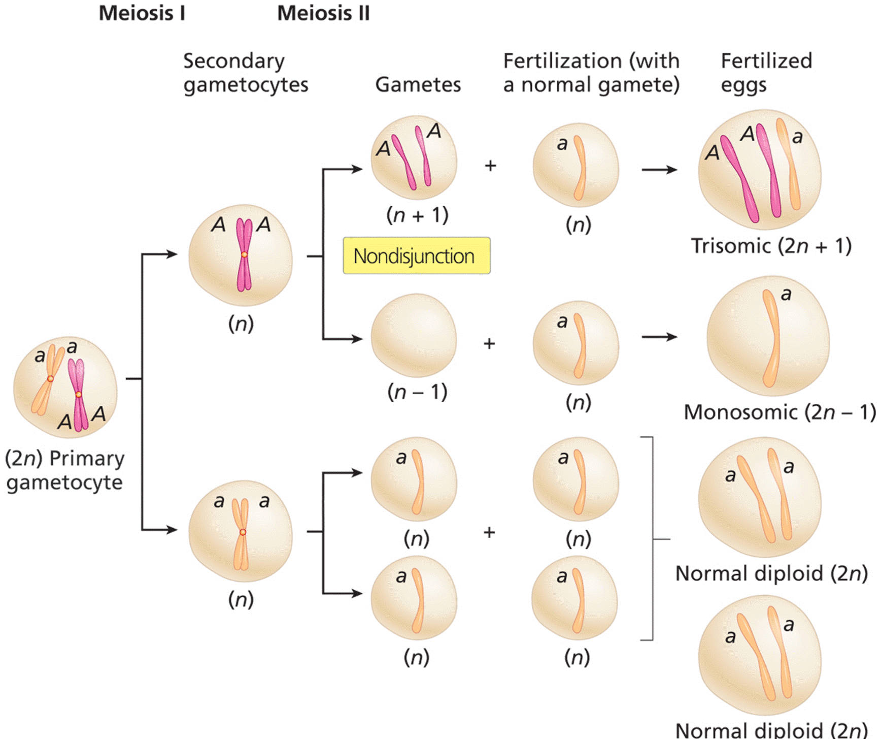 Meiosis II nondisjunction