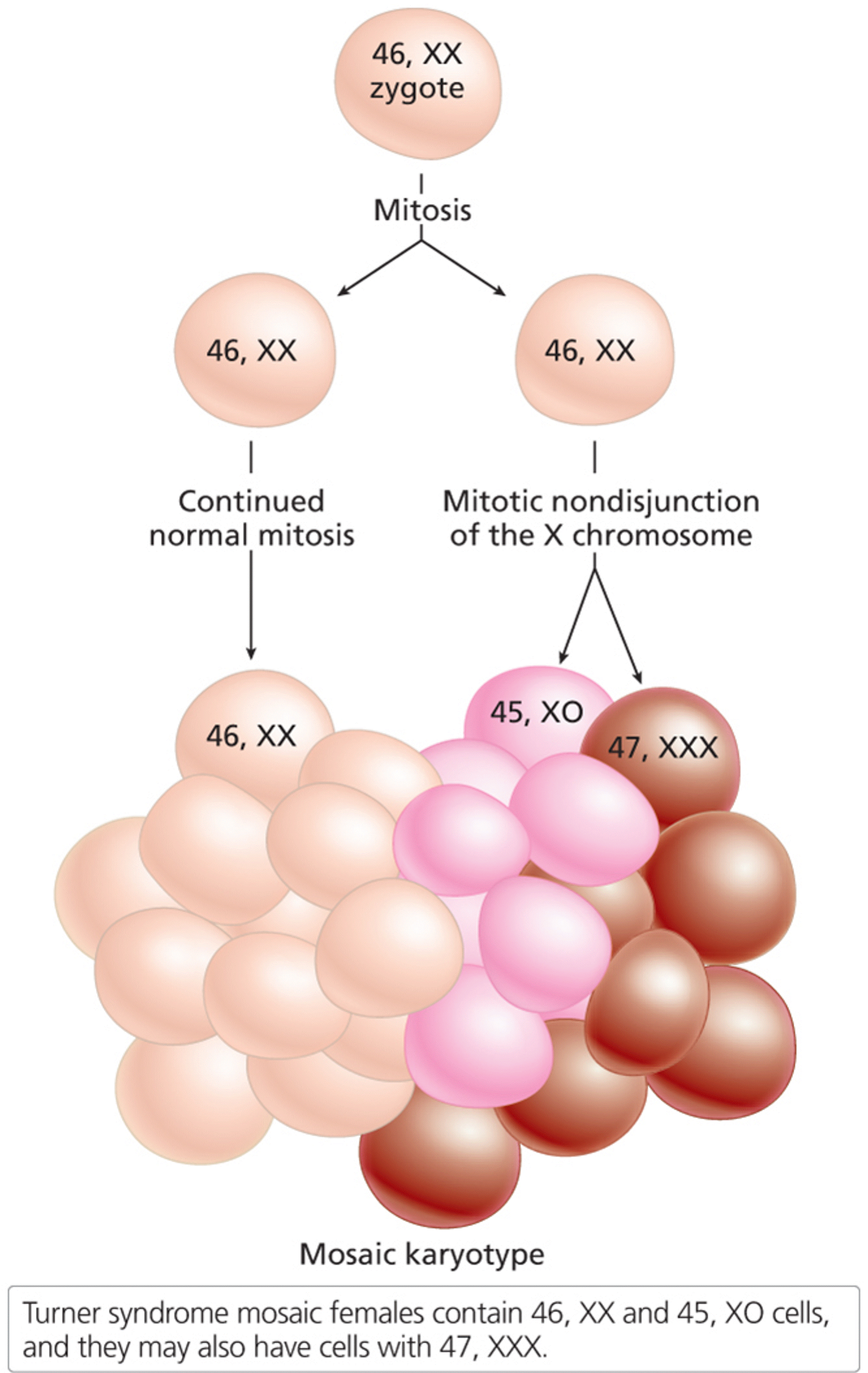 Chromosome mosaicism