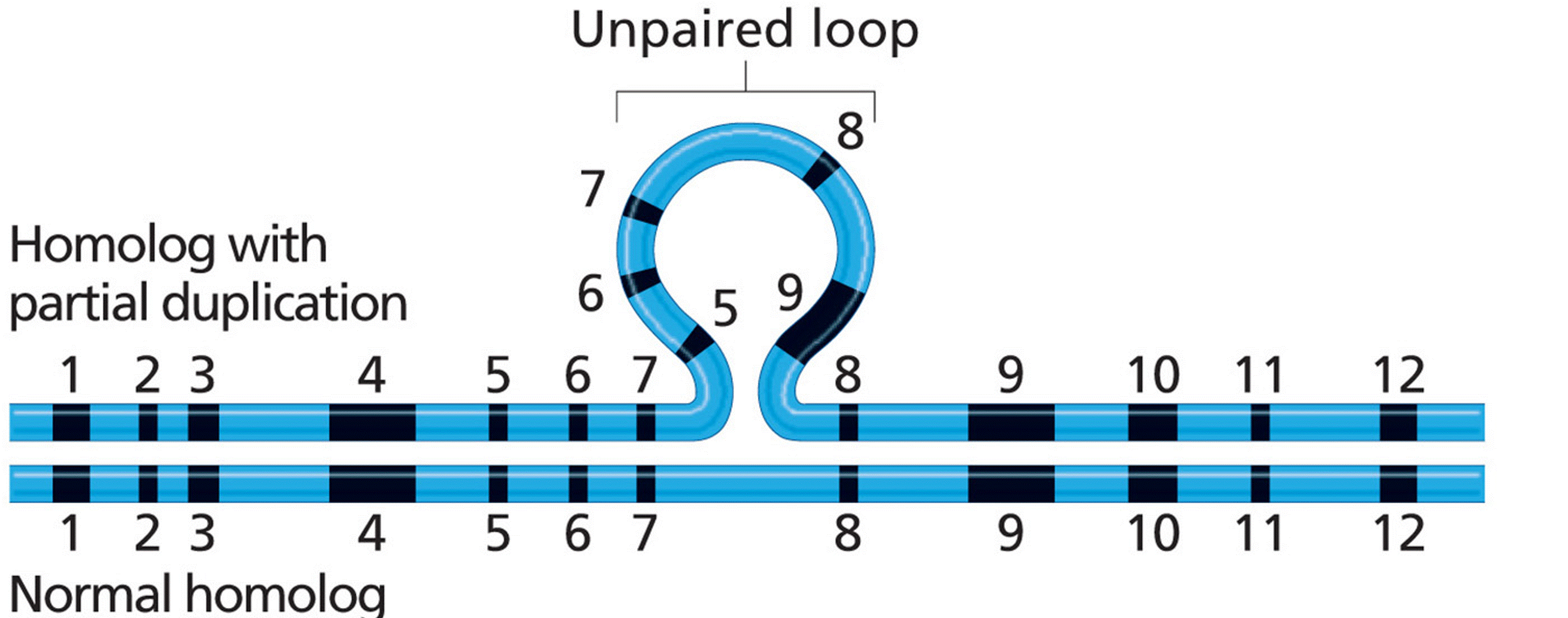 An unpaired loop at synapsis