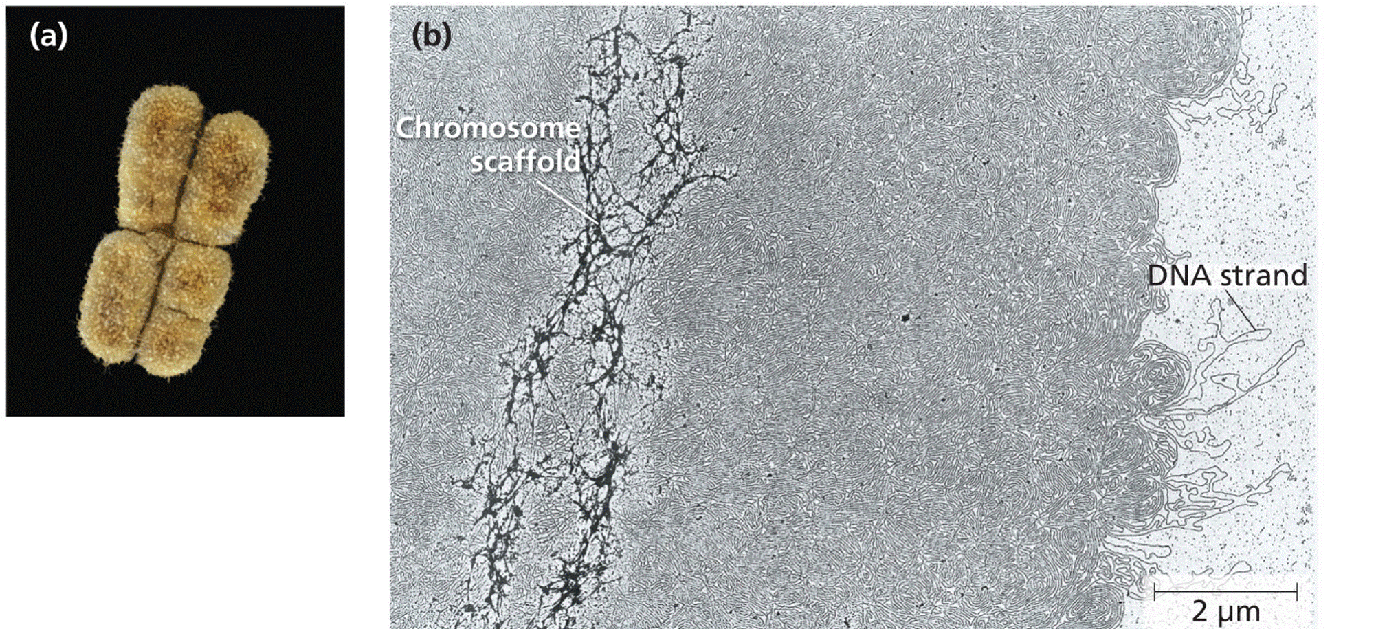 The chromosome scaffold of a metaphase chromosome