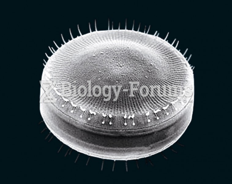 Scanning electron micrograph of a diatom