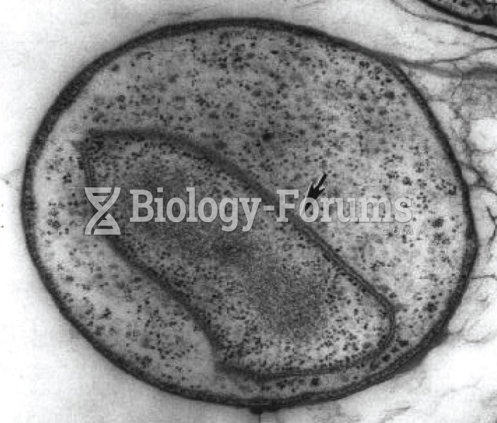 Bacteria with Internal Membranes