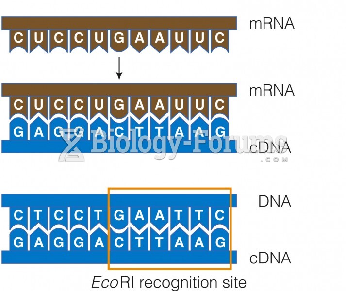 cDNA Cloning