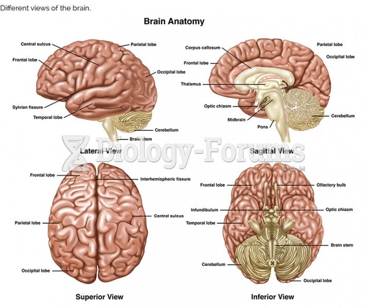 Different views of the brain