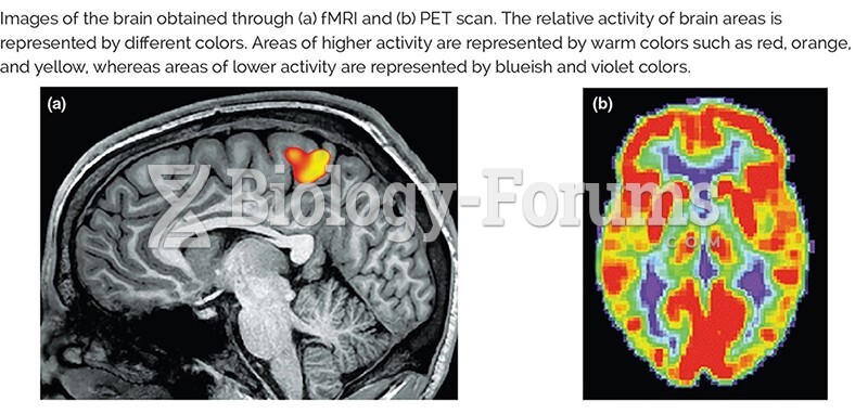 fMRI and PET scan of the brain