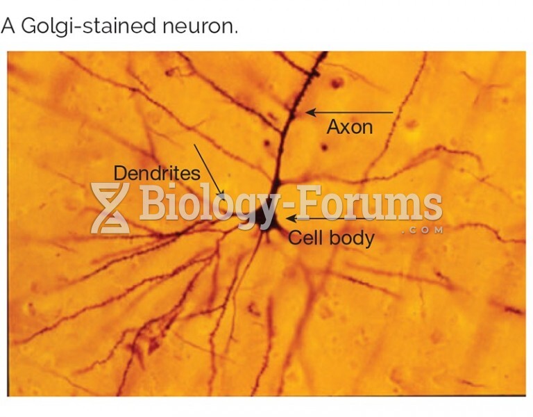 A Golgi-stained neuron