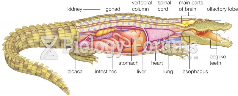 Body Plan of a Crocodile