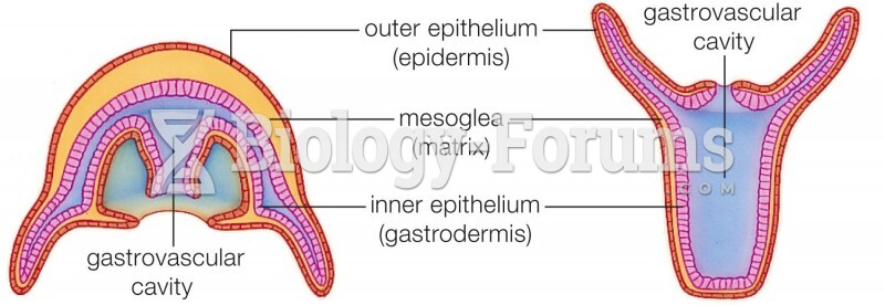 Two Cnidarian Body Plans