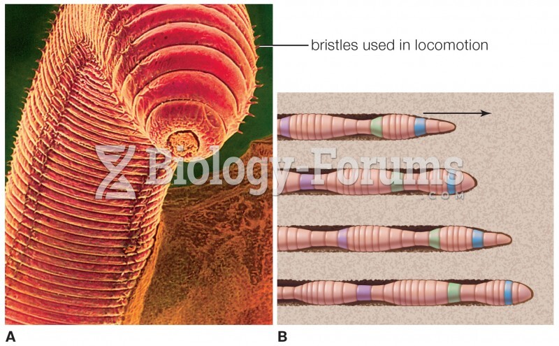 Coelomate Body Plan: Earthworm