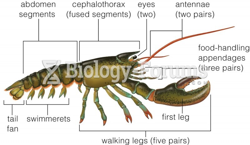 Body plan of a lobster (Homarus americanus)
