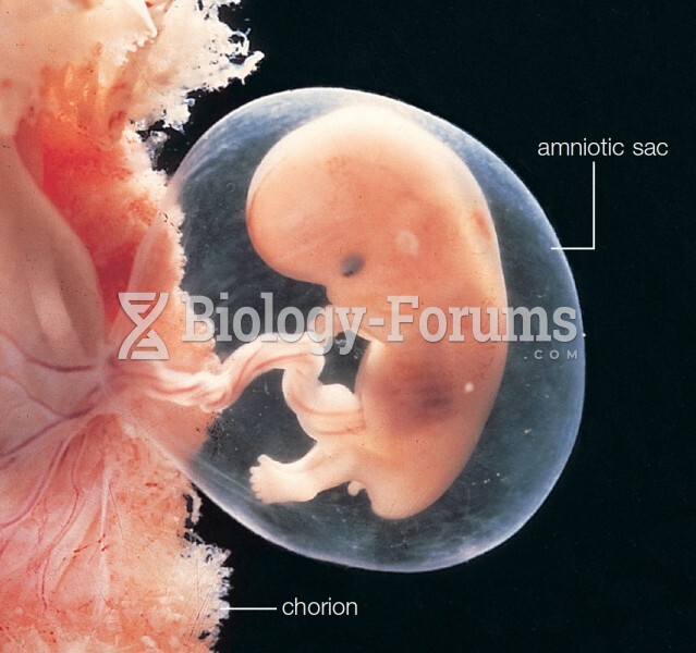 An 8-week-old fetus