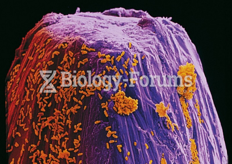 Bacteria on the Head of a Pin