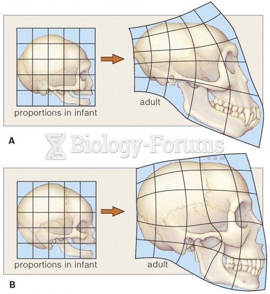 Proportional Changes During Skull Development: Human vs. Chimpanzee