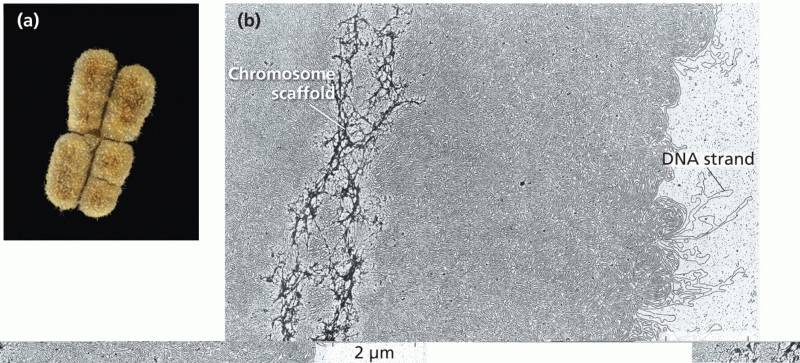 The chromosome scaffold of a metaphase chromosome