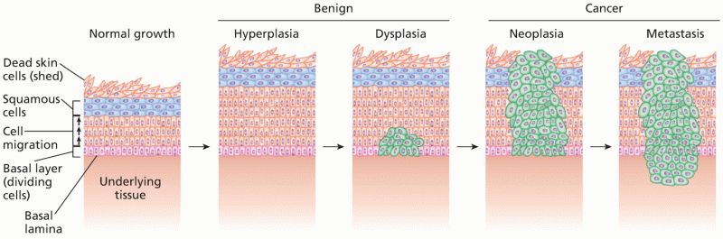 Abnormal tissue growth and cancer development